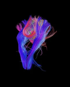 amygdala survival brain stress response 2